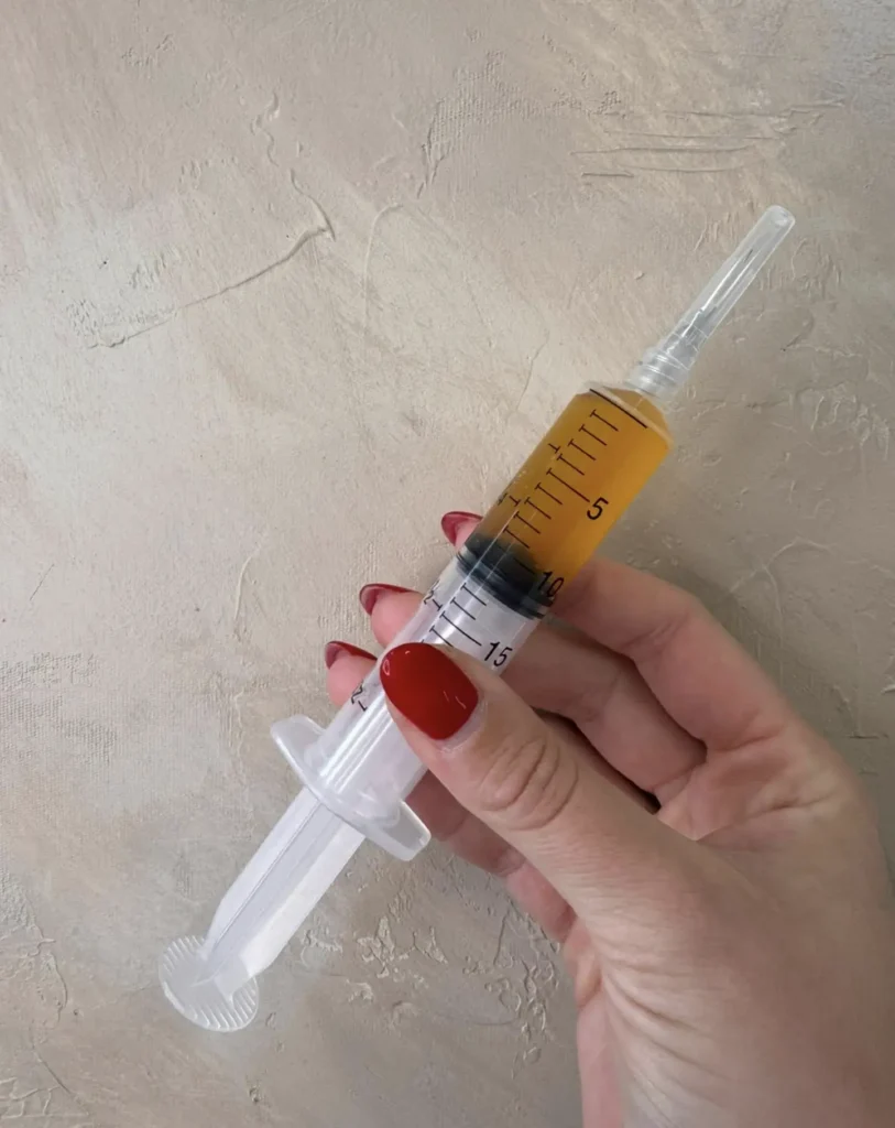PRP INJECTIONS