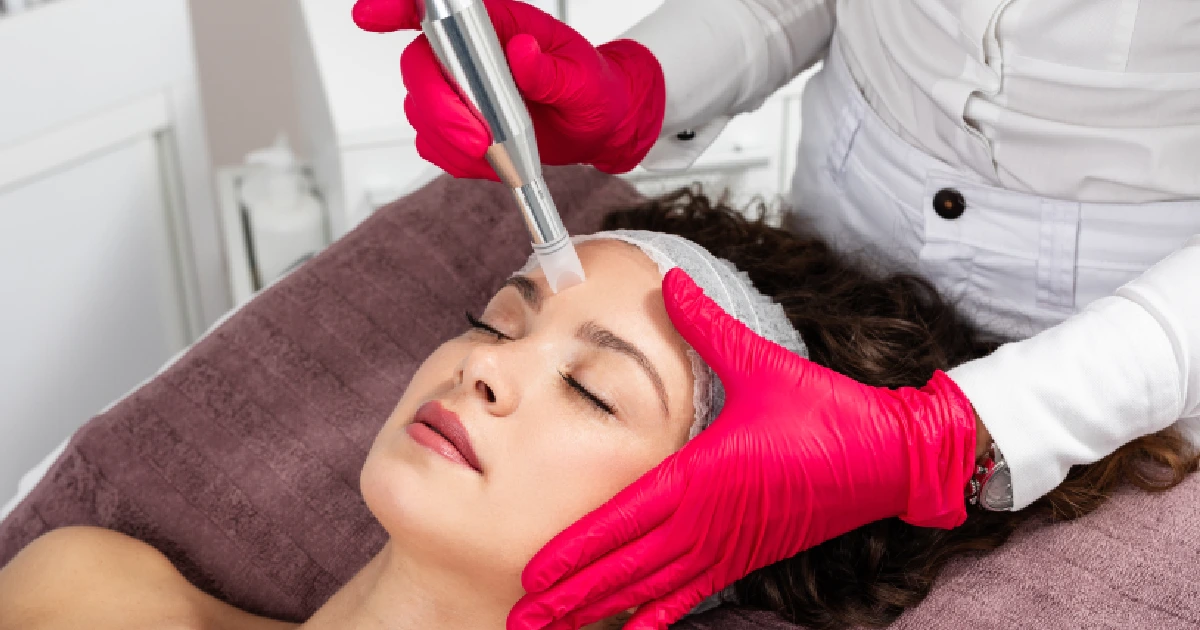 Women Receiving Microneedling in Alpharetta, GA