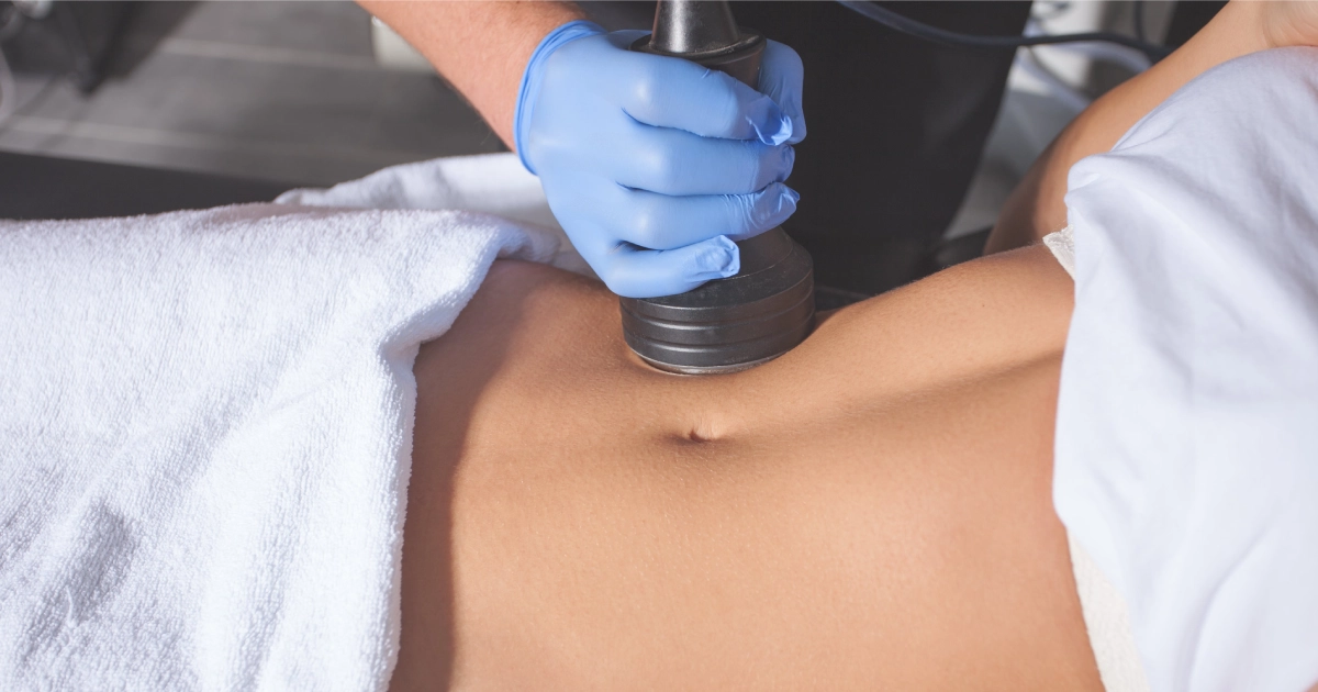 Cellulite reduction treatment on a woman's abdomen in Alpharetta, GA