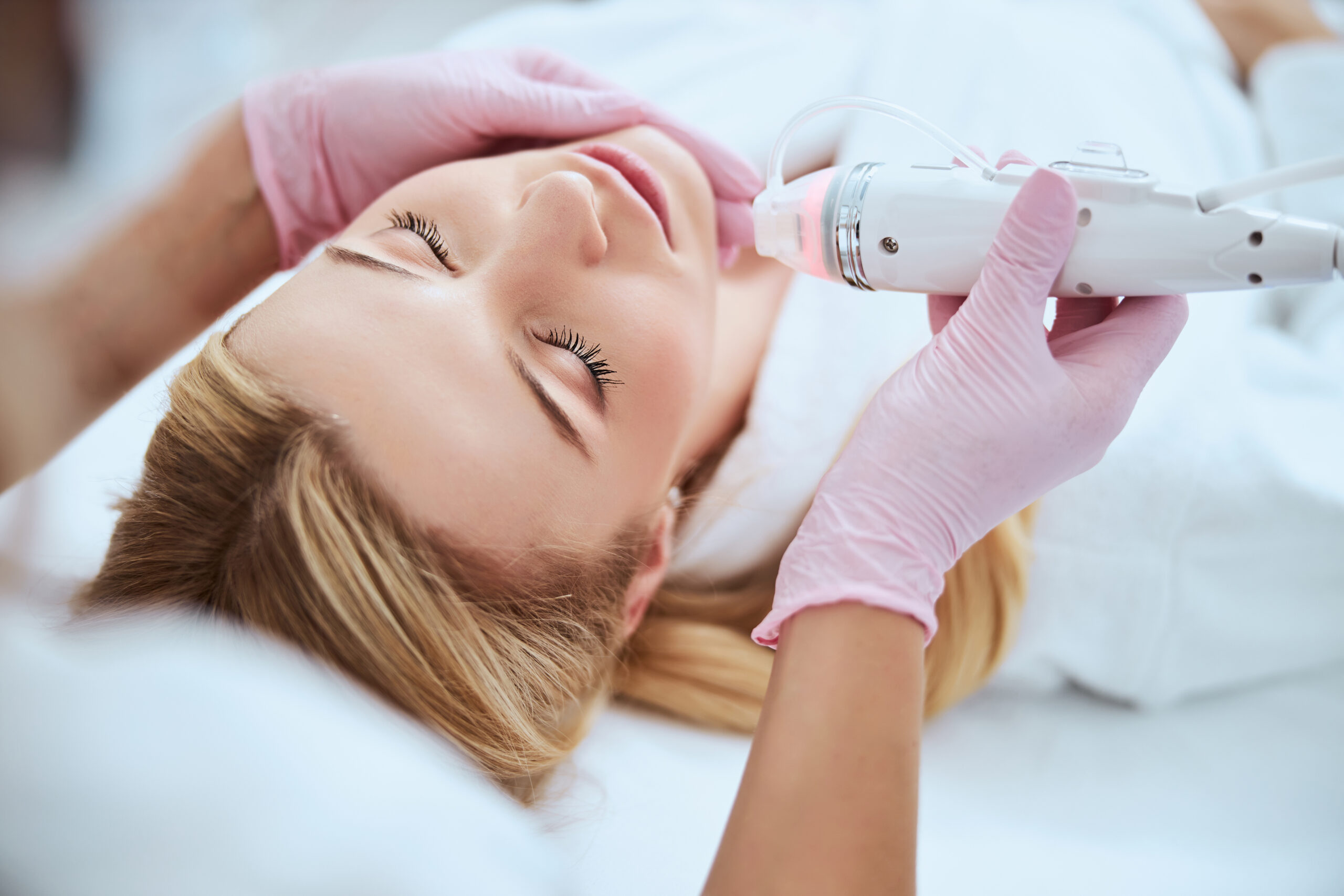 What to Expect From Your First Microneedling Treatment in Alpharetta, GA