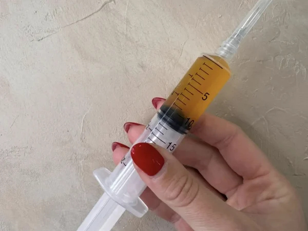 PRP INJECTIONS (2)